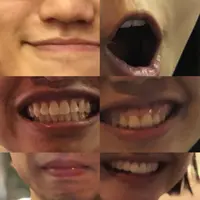 真.木嘴